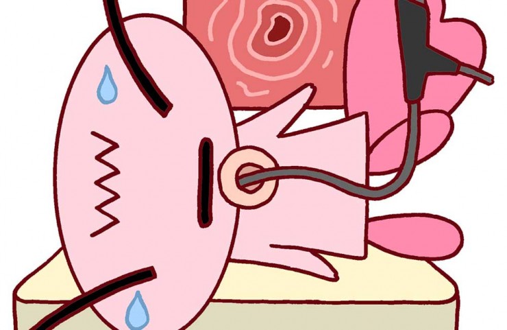 人生初の胃カメラ体験!異物感が想像以上で死にそうだった。