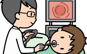 胃カメラの体験談と胃カメラにまつわるQ&A