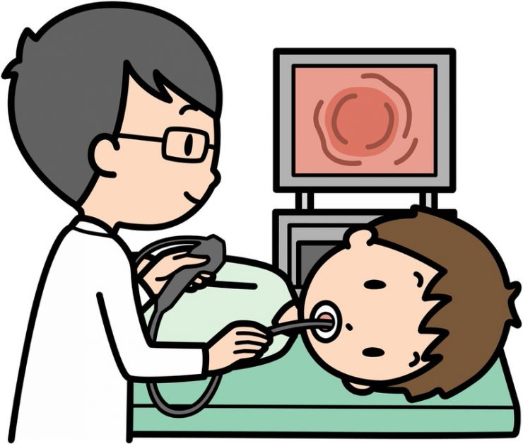 胃カメラの体験談と胃カメラにまつわるQ&A